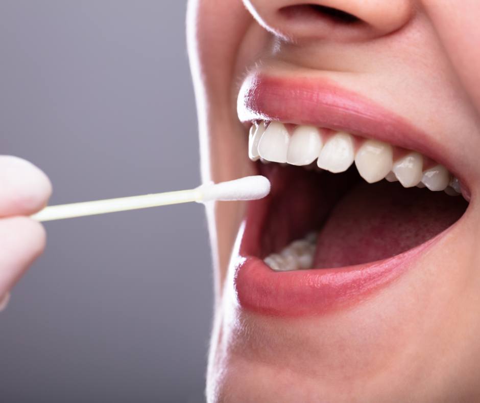 Test salivare cortisolo alto