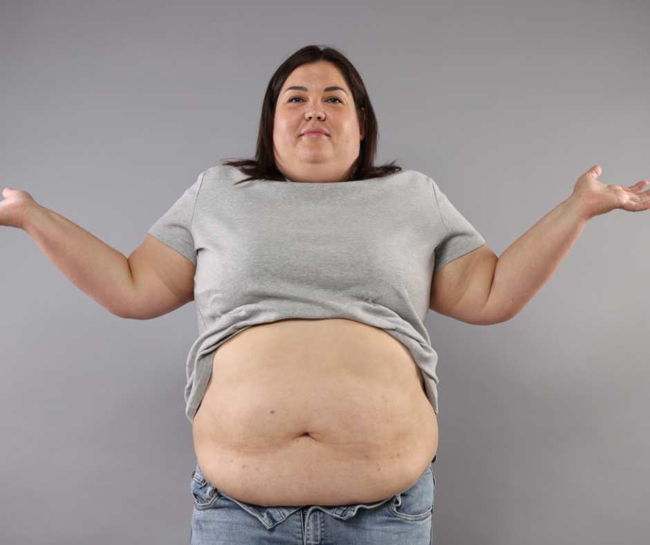 Obesità ginoide e dieta caratteristiche